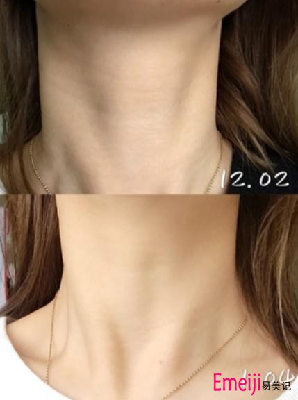 瑞斐时黑天鹅颈霜