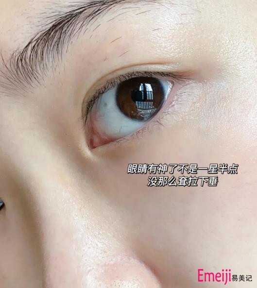 专妍太空舱眼部精华