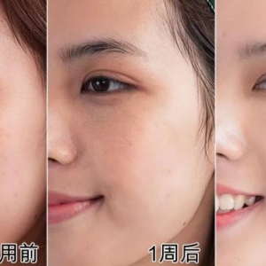 亲测非常有效的改善敏感肌四款面霜