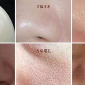 如何科学缩小毛孔呢?